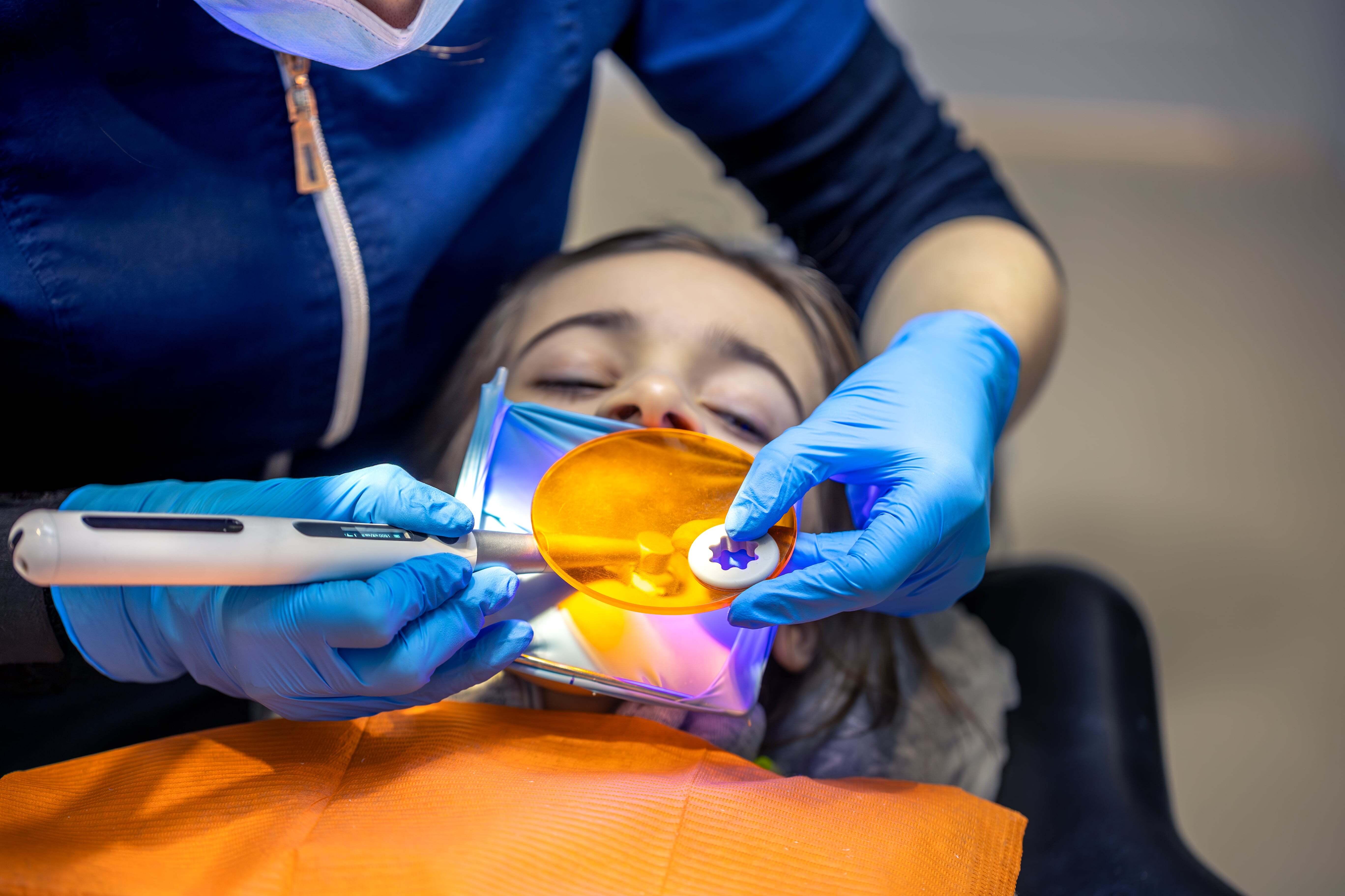 Fillings-min