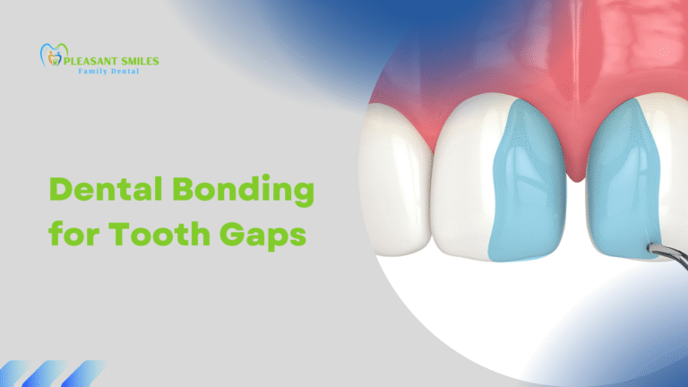 Dental Bonding for Tooth Gaps