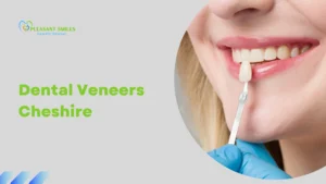 Dental Veneers Cheshire