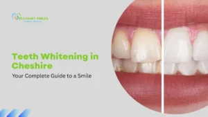 Teeth Whitening in Cheshire