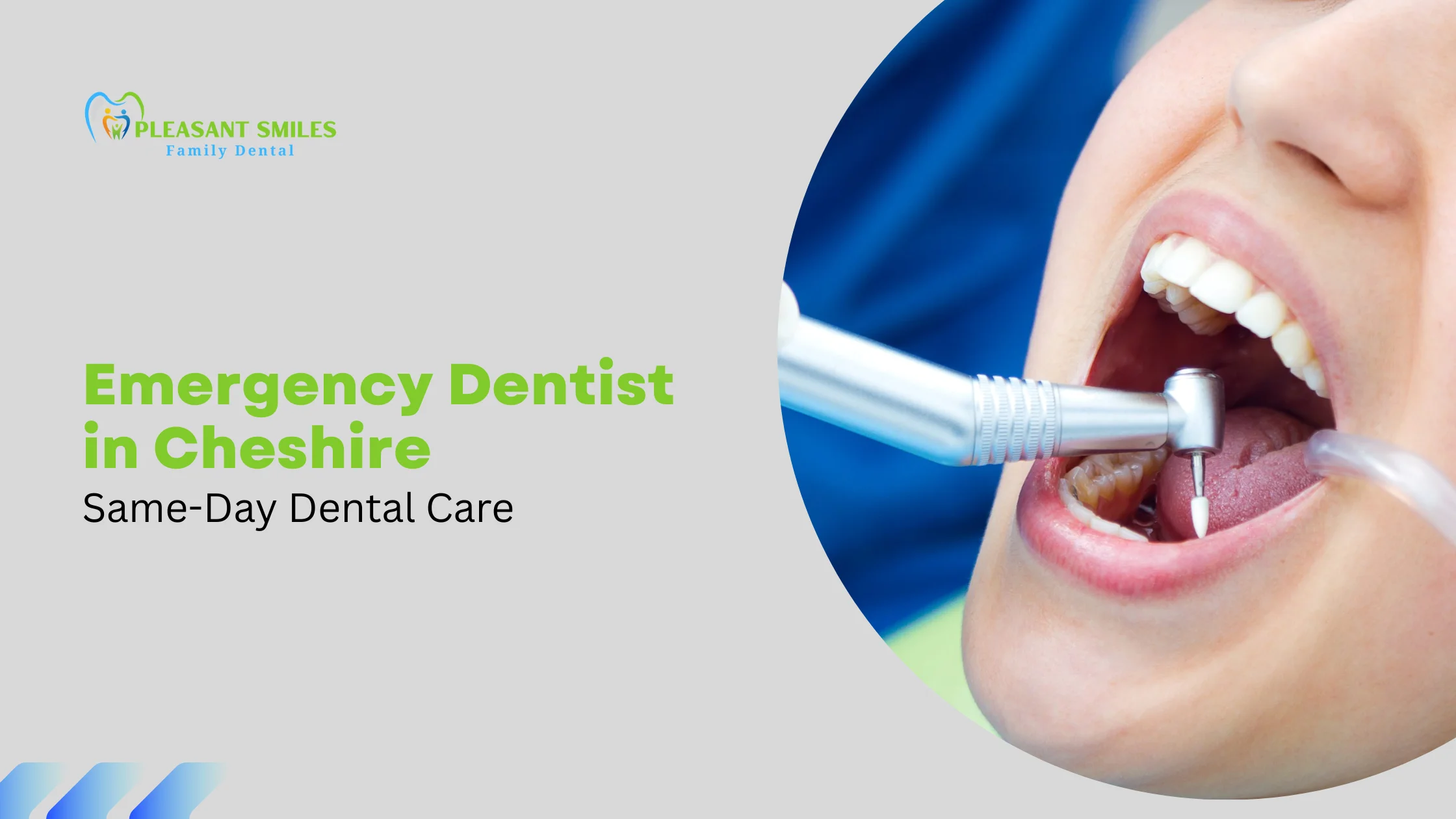 Emergency Dentist in Cheshire