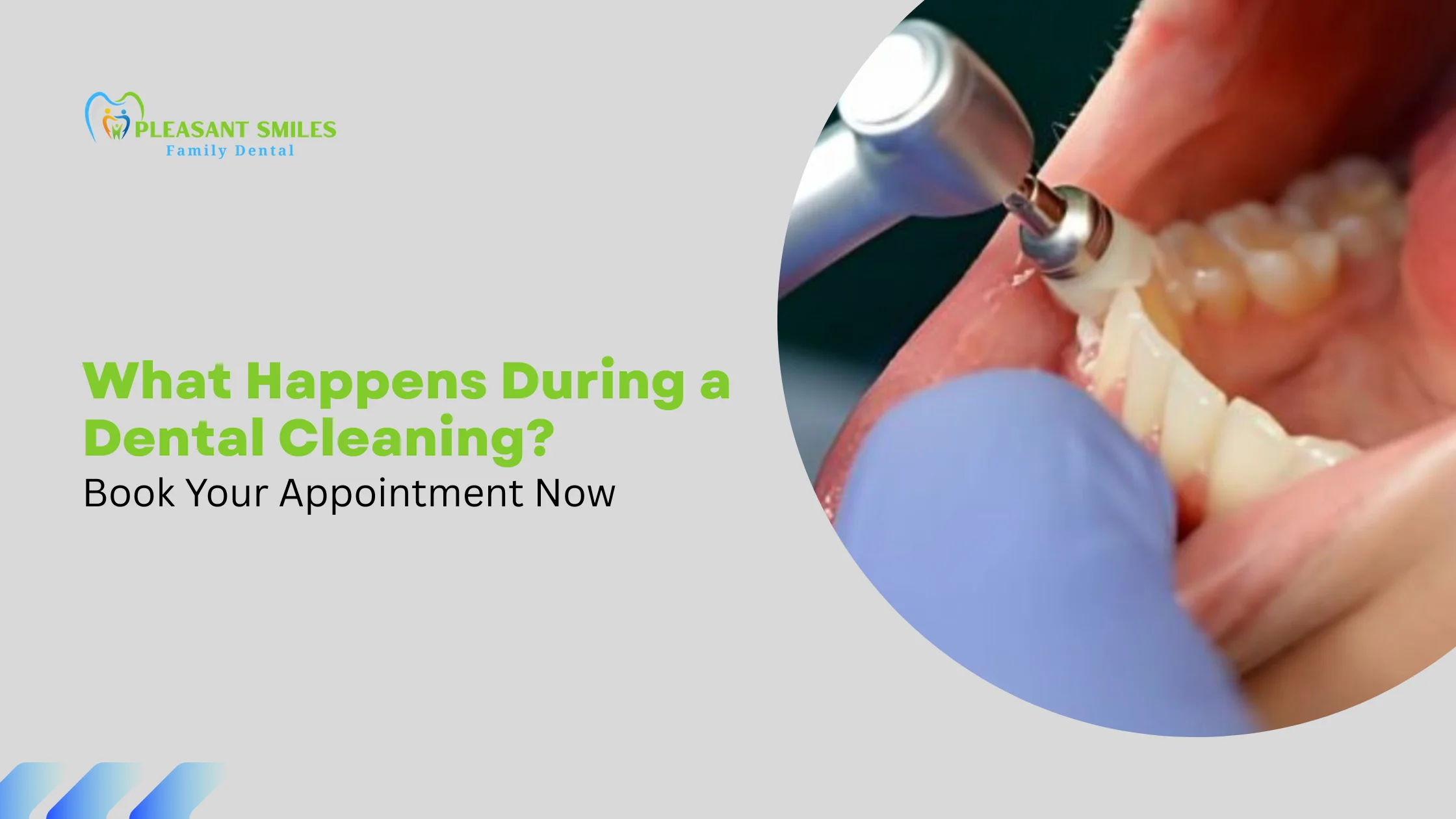 What Happens During a Dental Cleaning