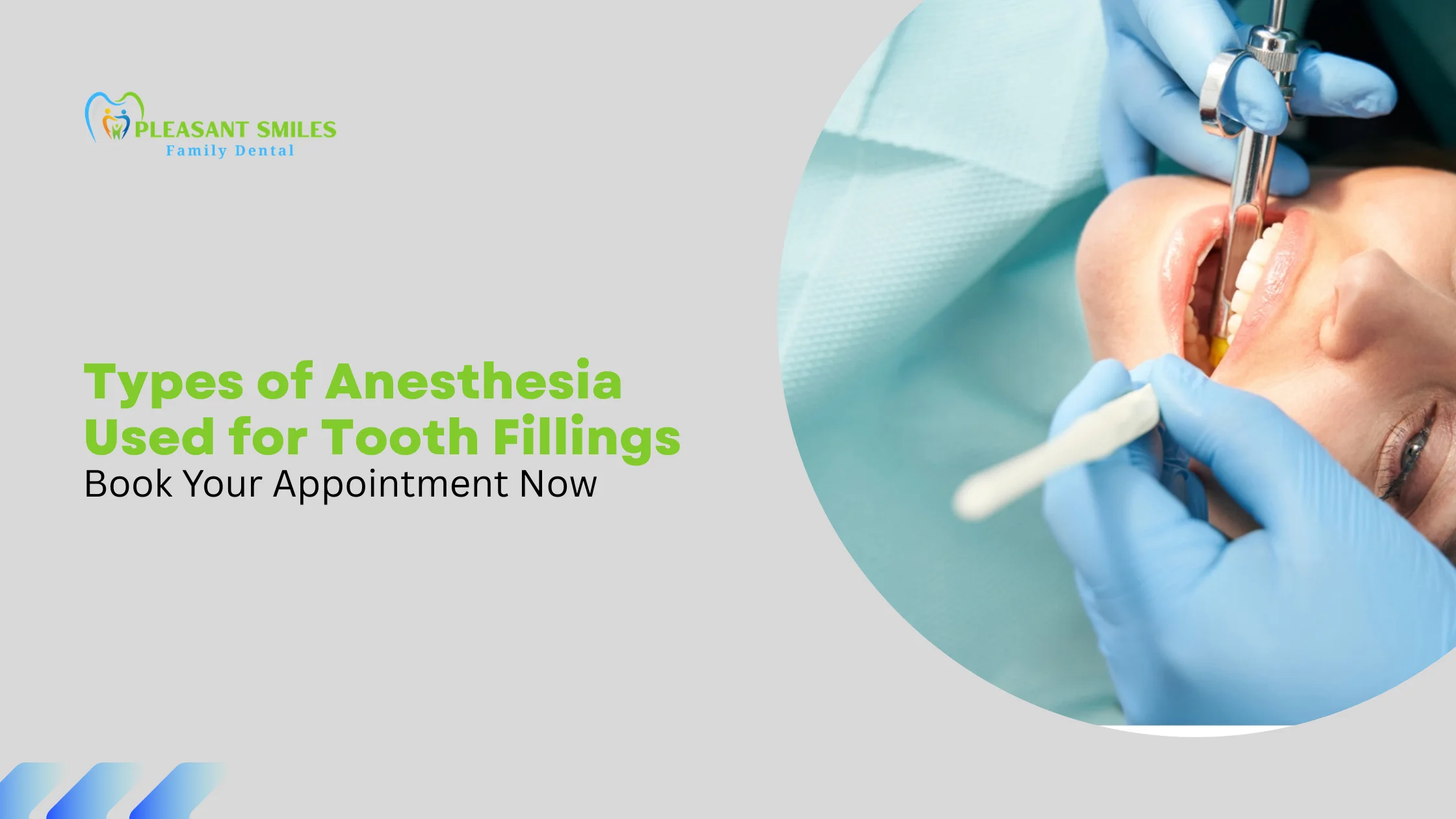 Types of Anesthesia Used for Tooth Fillings
