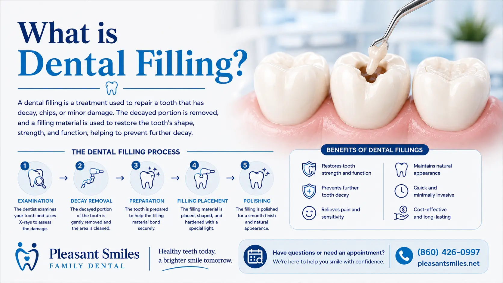 What is Dental Filling?