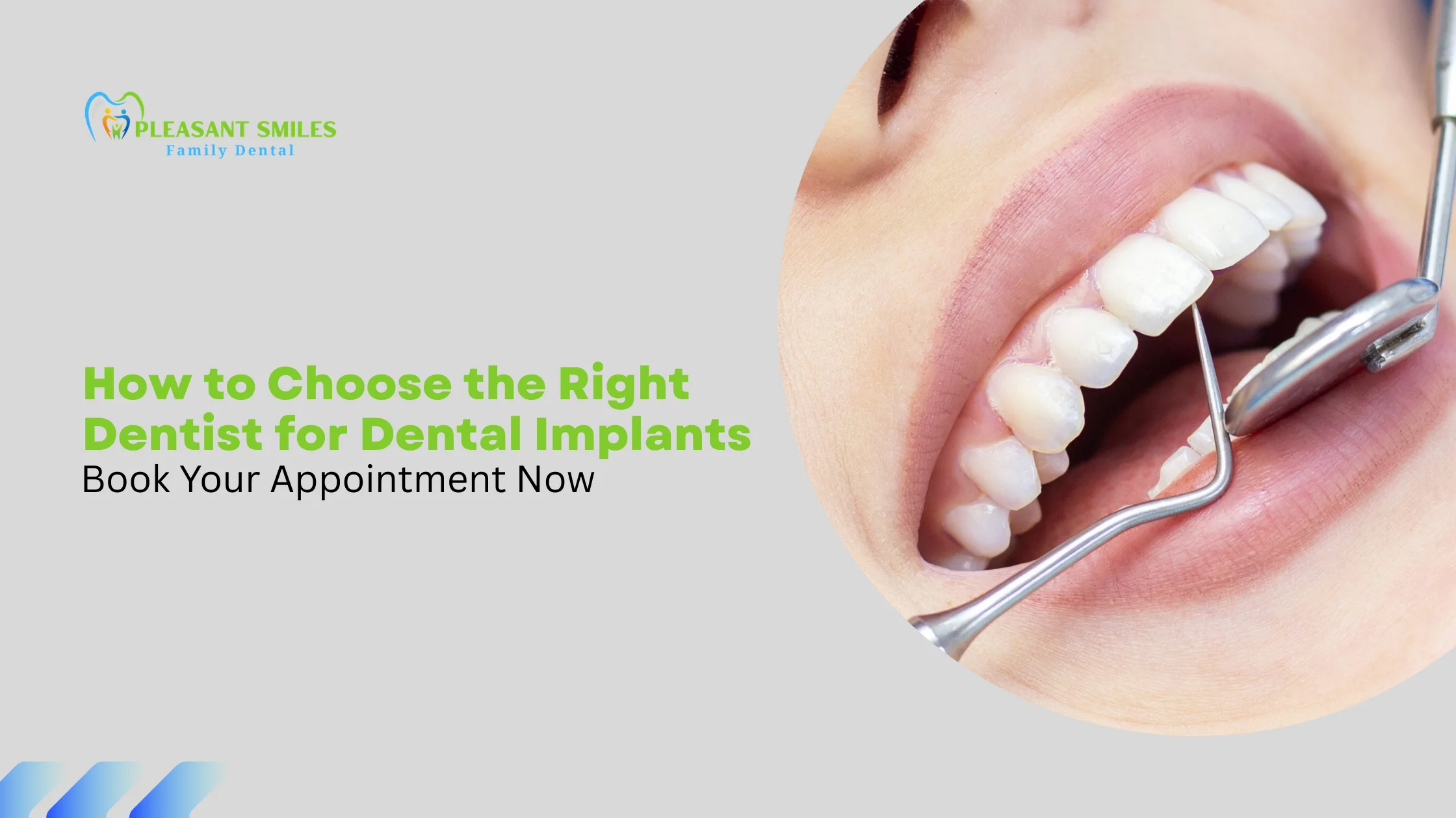 What Type of Dentist Does Implants