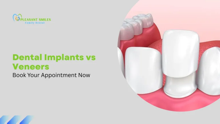Dental Implants vs Veneers