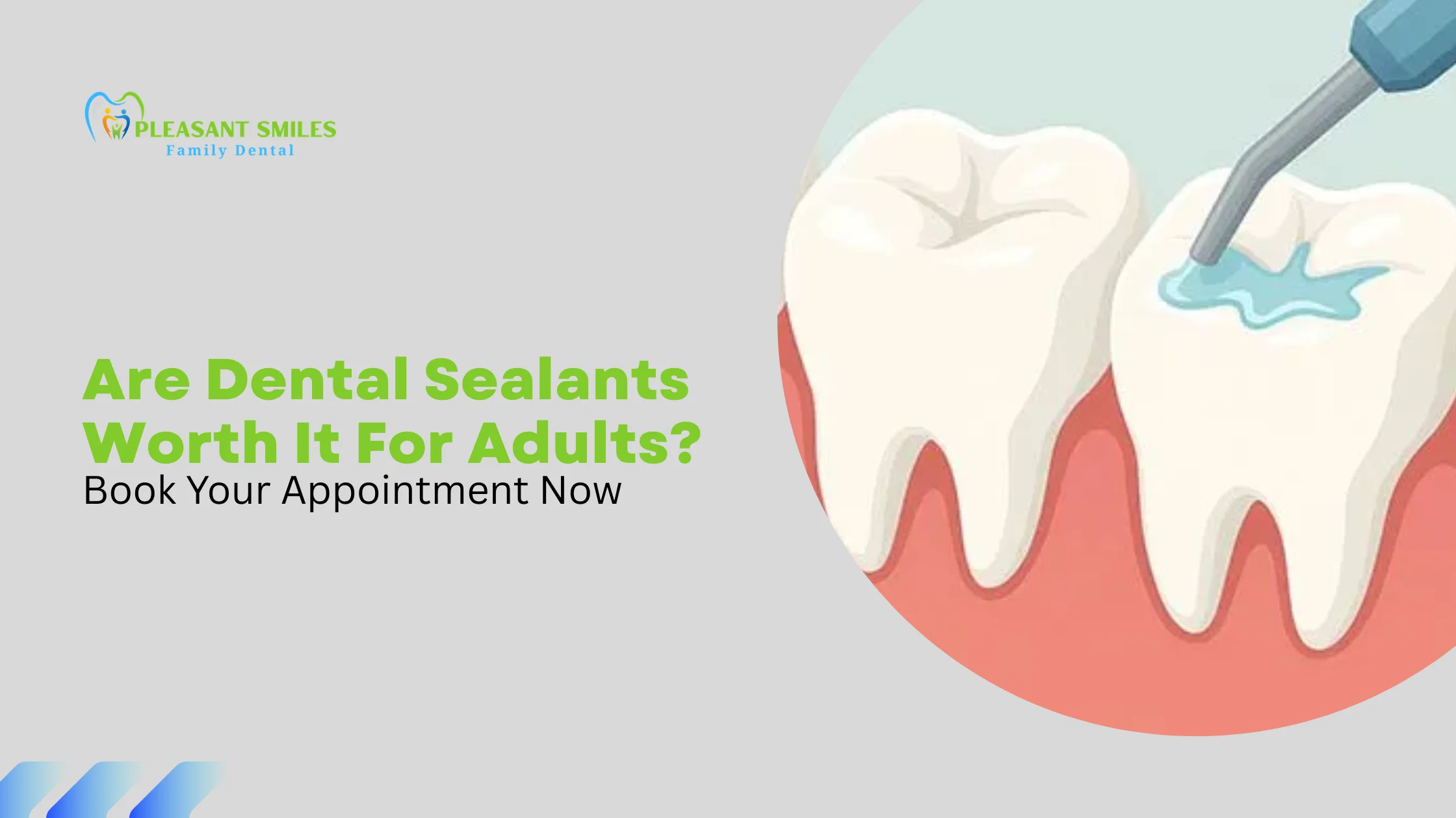 Are Dental Sealants Worth It For Adults