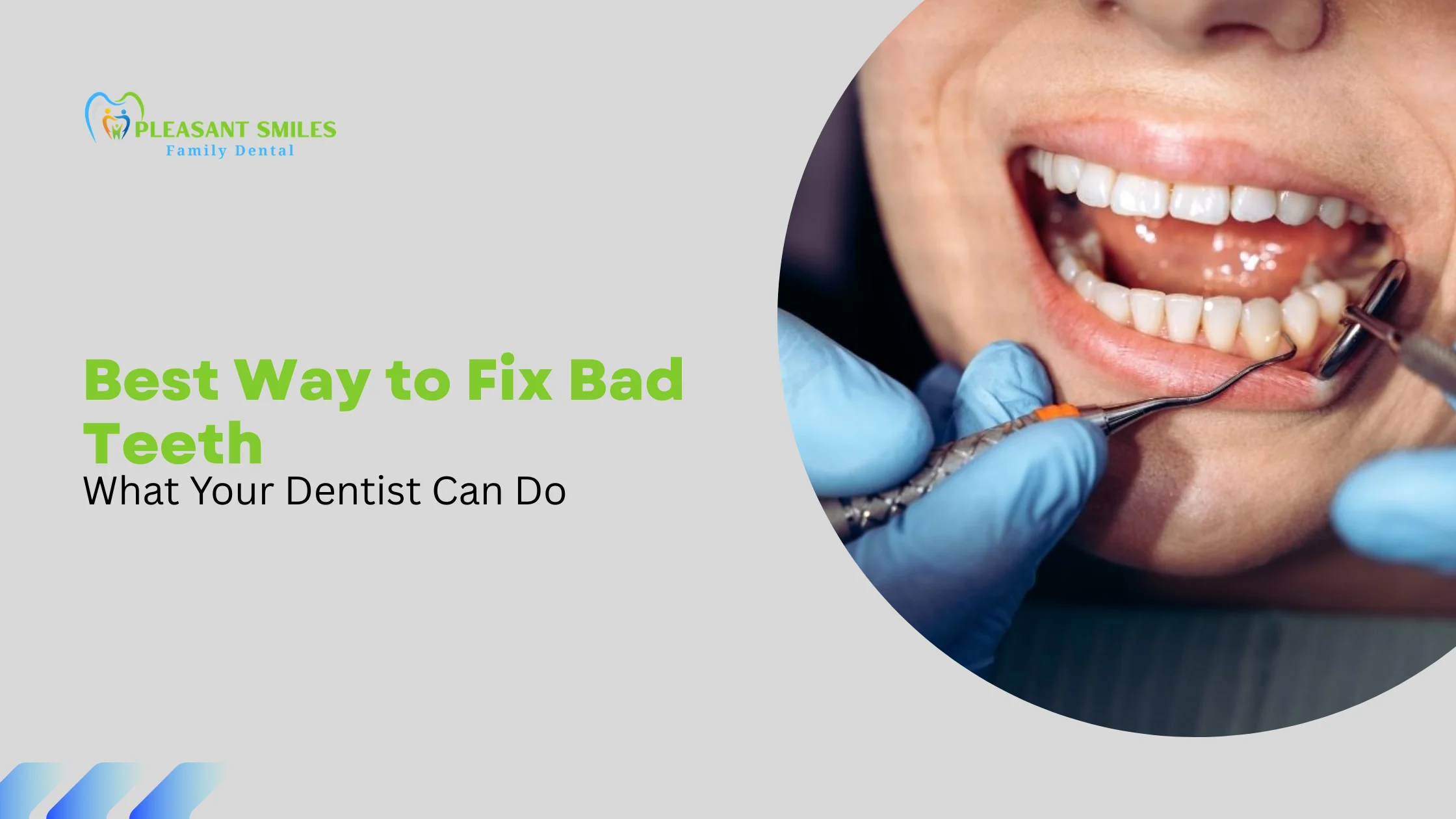 Best Way to Fix Bad Teeth