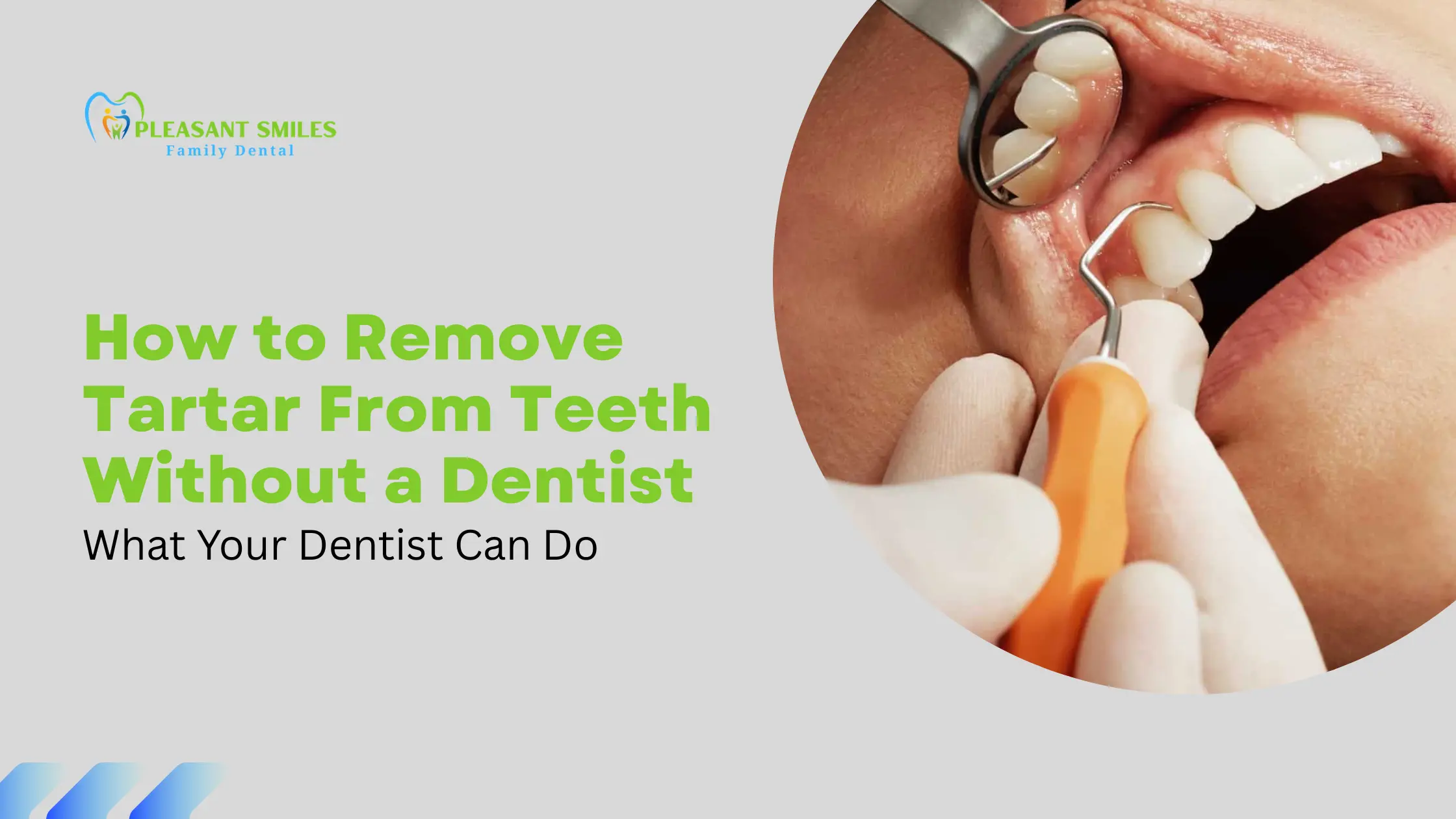 How to Remove Tartar From Teeth Without a Dentist