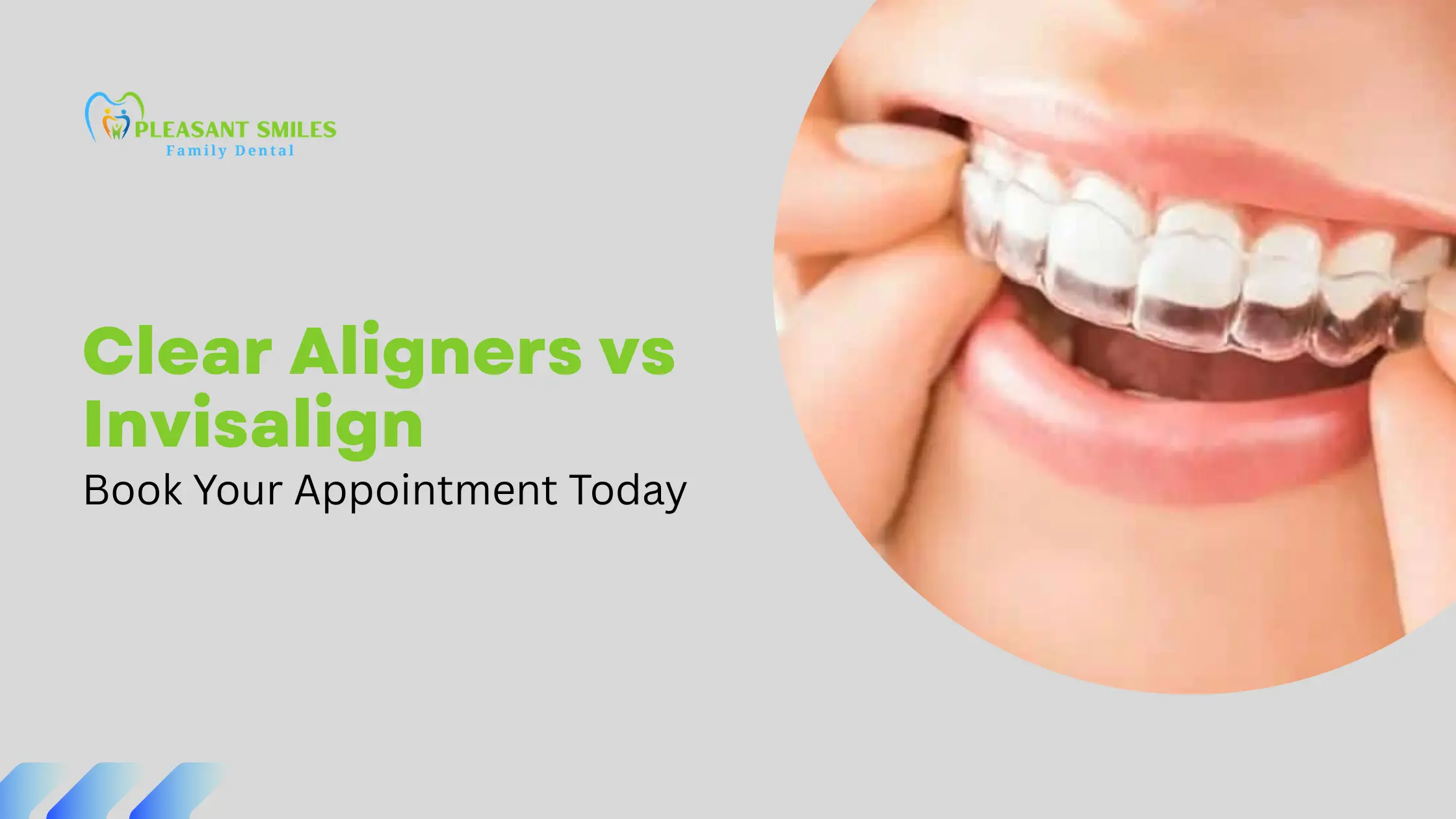 Clear Aligners vs Invisalign
