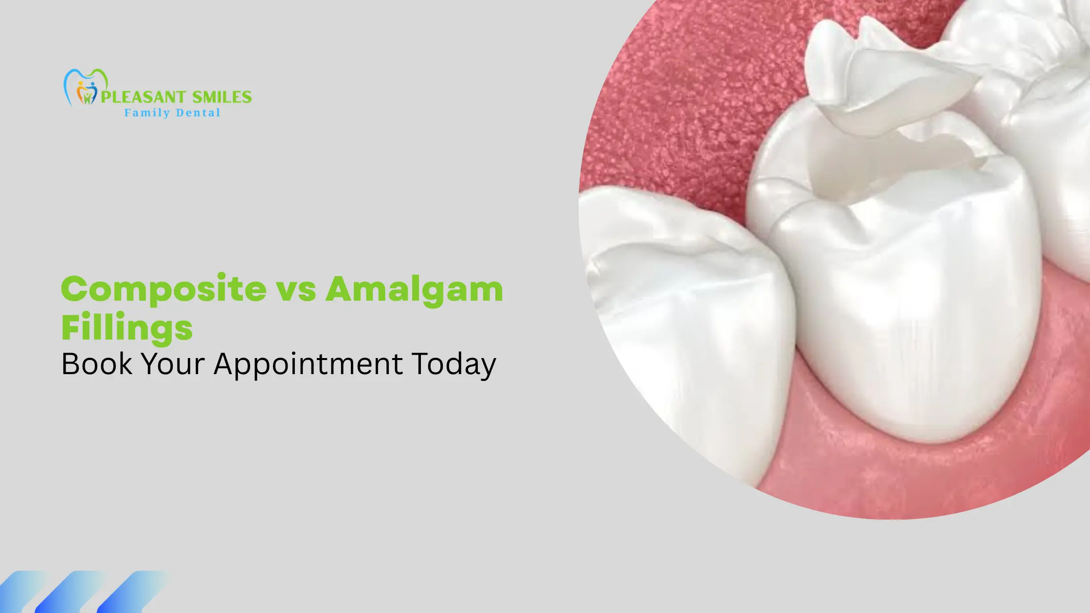 Composite vs Amalgam Fillings: Which is Right for You?