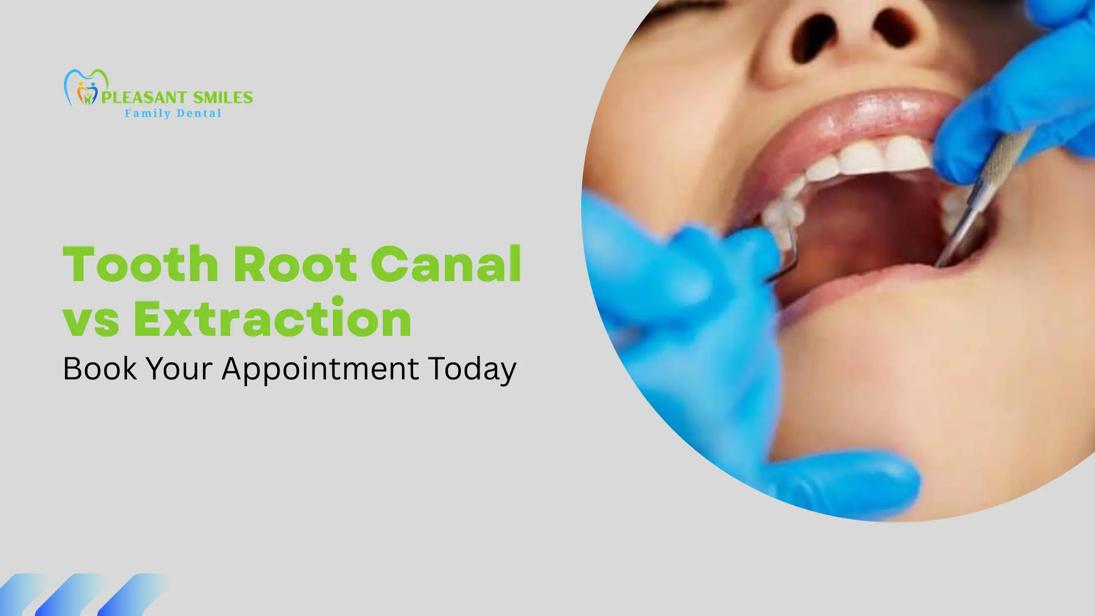 Tooth Root Canal vs Extraction