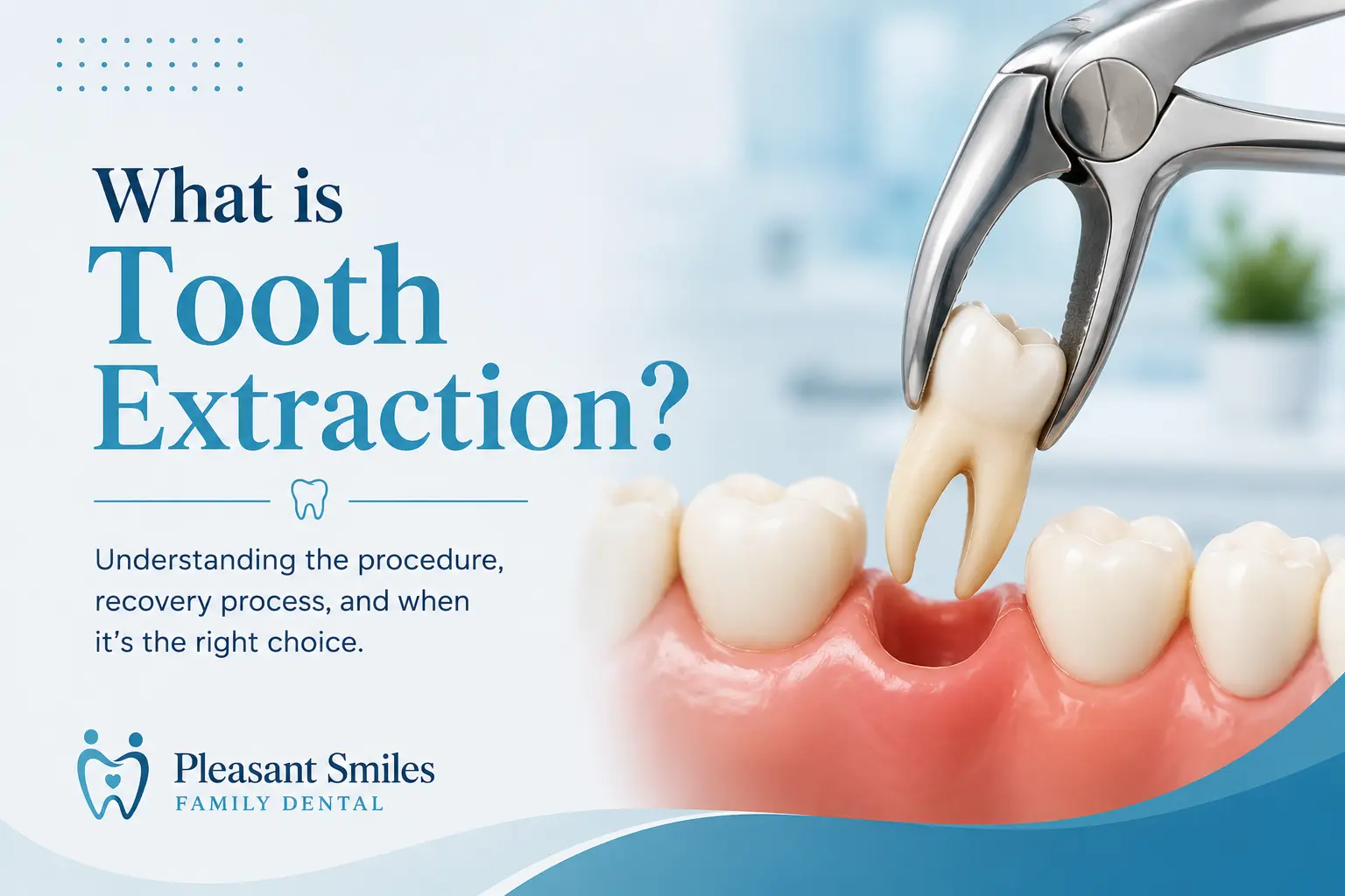 What is Tooth Extraction?